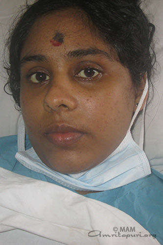 Siju,  Amrita Hospitals' Liver transplant  patient