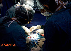 Over 1000 Organ transplantations at Amrita hospital
