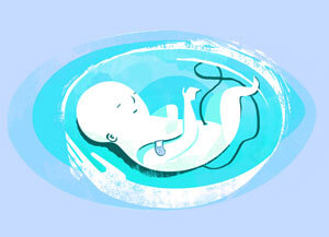 Amrita Hospital does laser surgery to unborn baby to save kidneys